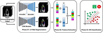 Ensemble learning of myocardial displacements for myocardial infarction detection in echocardiography
